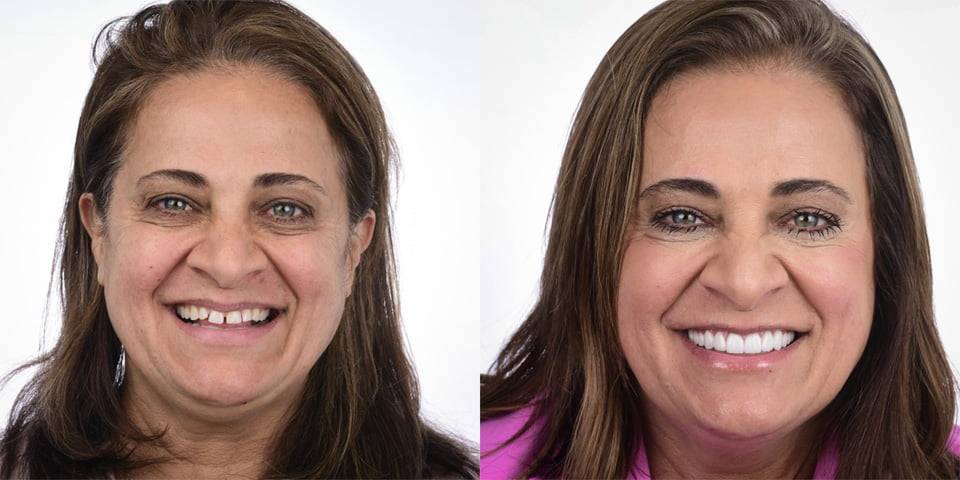 White Space Dental Patient