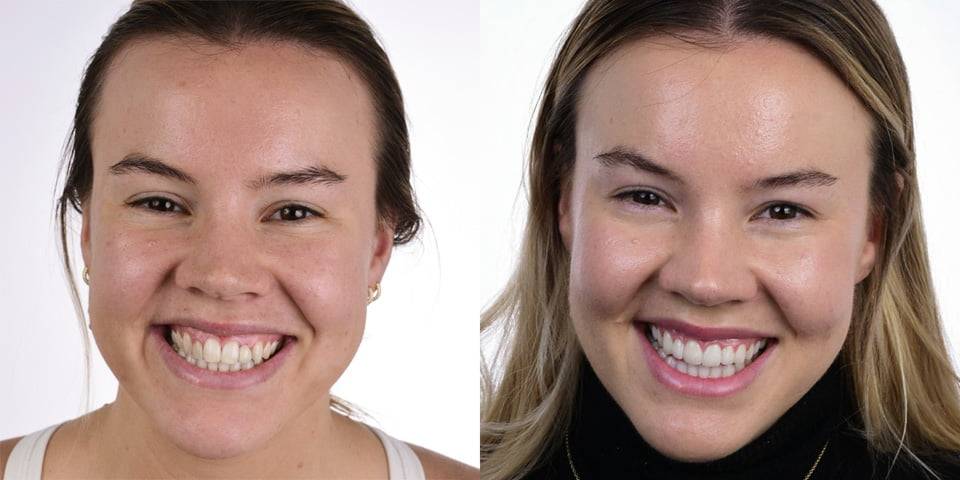 White Space Dental Patient