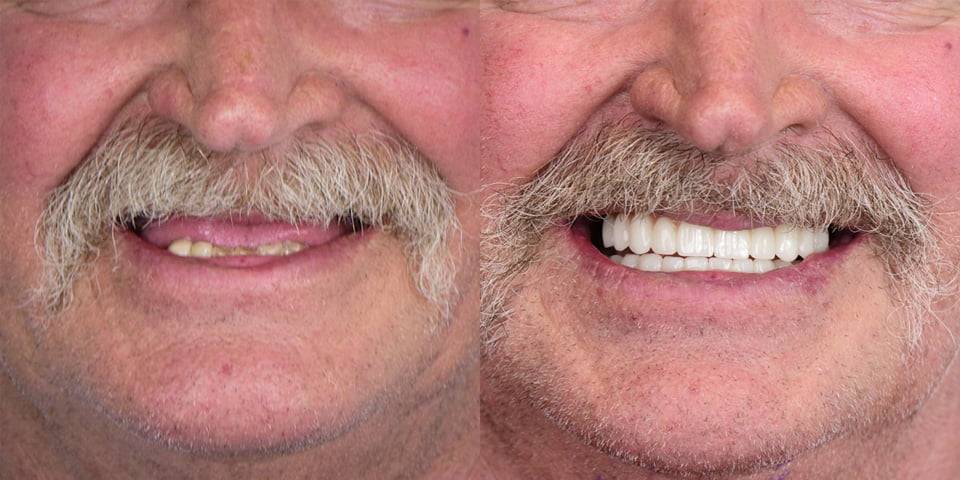 White Space Dental Patient