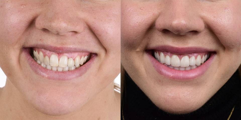 White Space Dental Patient