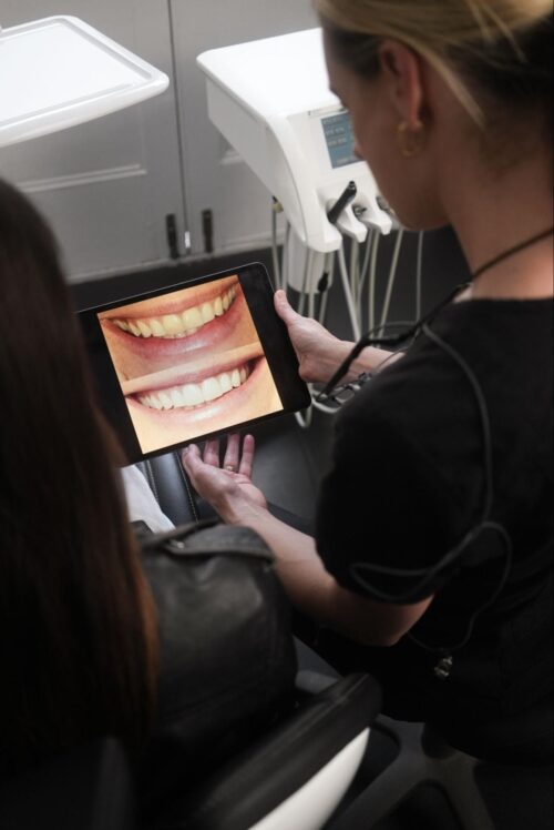 Cosmetic Dental Treatments From Quick Fixes to Full Makeovers - Whitespace Dental